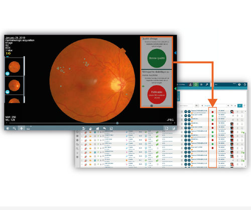 Software für Ophthalmologie - OphtAI - EVOLUCARE - Management / Diagnose / Früherkennung der diabetischen Retinopathie
