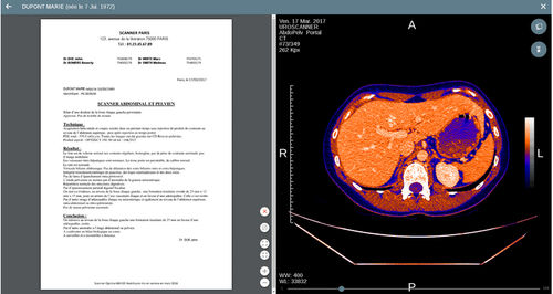 Viewer-Software - Uview - EVOLUCARE - medizinisch / für Radiologie / Diagnose