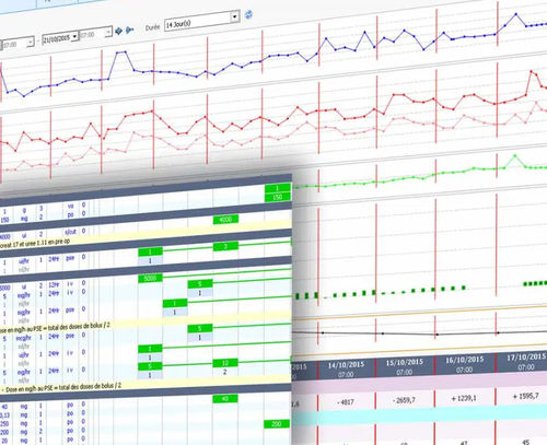 Informationsmanagementsystem - EVOLUCARE - Daten / für Intensivpflege
