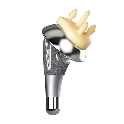 Zementfreie Schulterprothese - AltiVate® - Enovis Surgical