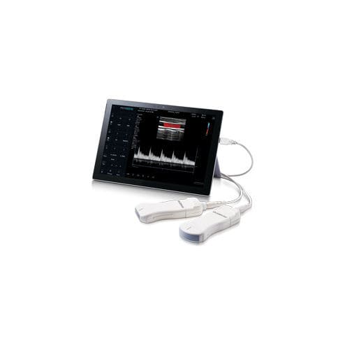 Ultraschall-Handgerät - minisono - Alpinion Medical Systems - für Multifunktions-Ultraschall / Schwarz-Weiß / Farbdoppler