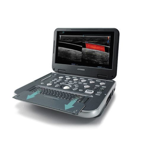 Tragbares Ultraschallgerät - E-CUBE i7 - Alpinion Medical Systems - für Multifunktions-Ultraschall / Farbdoppler / mit integrierter Konsole