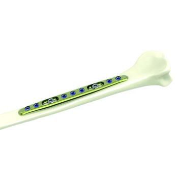 Kompressionsplatte für Radius - ETSIS1 - Newclip Technics - für Ulna / medial / mit Verriegelung