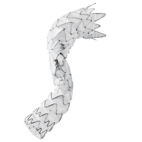 Thoraxaorta Stentgraft - E-nside™ TAAA - Artivion - Nitinol / ePTFE