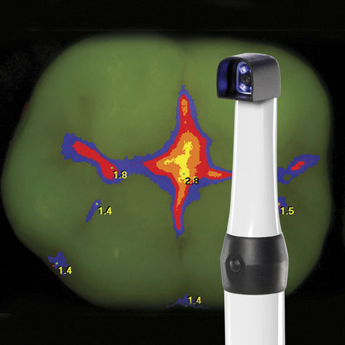 Intraorale Kamera - CamX Spectra - Air Techniques - digital / fluoreszierend