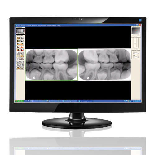 Software für dentale Bildgebung - Visix® - Air Techniques