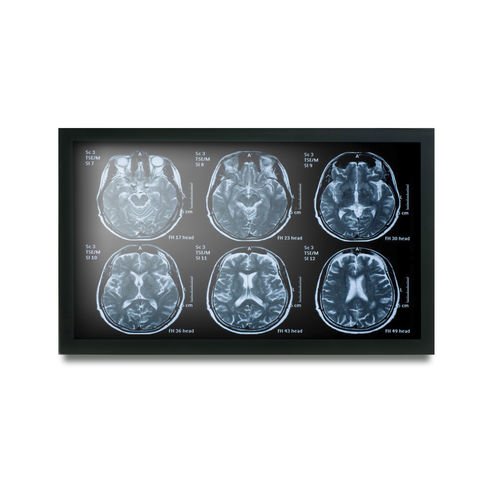 19"-Monitor - MEDDP-622 - Onyx Healthcare Inc - LCD / mit LED-Hintergrundbeleuchtung / mit Touchscreen