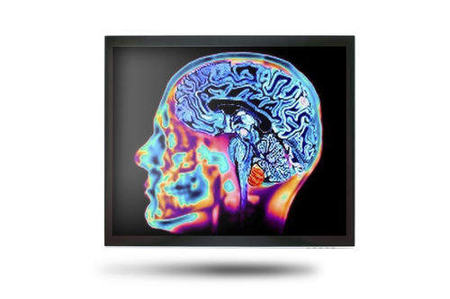 Medizinisch Monitor - MEDDP-415 - Onyx Healthcare Inc - 17" / LCD / mit LED-Hintergrundbeleuchtung