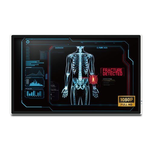 4K-Monitor - MEDDP-632F - Onyx Healthcare Inc - 32" / LCD / lüfterlos