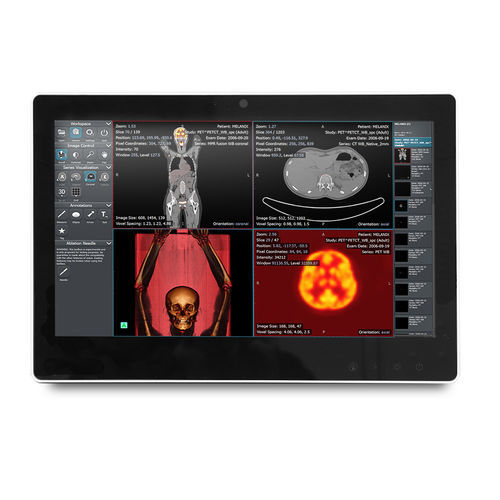 Medizinischer Panel-PC / Intel® Celeron® - SMA-1533 - Onyx Healthcare Inc - Intel® Atom Dual Core / für die Intensivstation / für Computerwagen