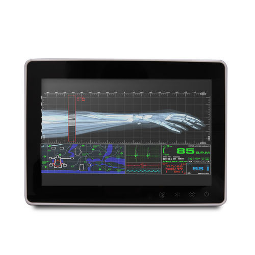 Medizinischer Panel-PC / Intel® Atom Dual Core - SMA-1033 - Onyx Healthcare Inc - Intel® Celeron® / all-in-one / mit RFID-Technologie