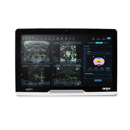 Medizinischer Panel-PC / Intel® Core i3 - MATE2-2215 - Onyx Healthcare Inc - Intel® Core™ / Intel® Core i5 / Intel® Core i7