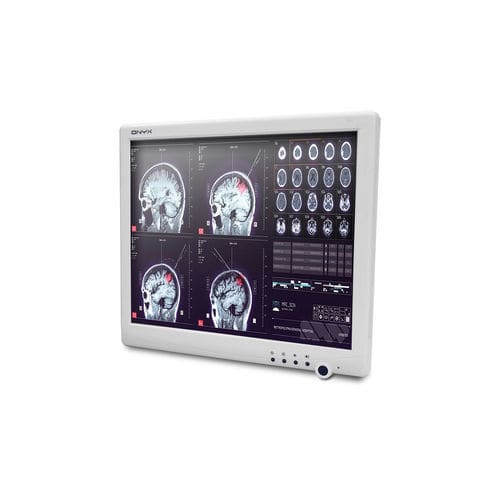 Medizinischer Panel-PC / Intel® Celeron® - SMA-1733 - Onyx Healthcare Inc - Intel® Atom Dual Core / ohne Lüfter / mit Touchscreen