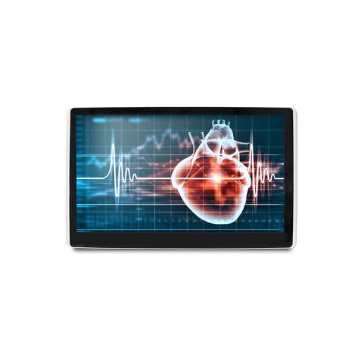 Medizinisch Monitor - MEDDP-615 - Onyx Healthcare Inc - 18,5" / LCD / mit LED-Hintergrundbeleuchtung