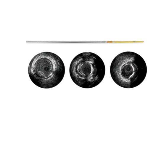 Diagnosekatheter - Refinity - Spectranetics - Koronar / linker Vorhof / mit hydrophiler Beschichtung