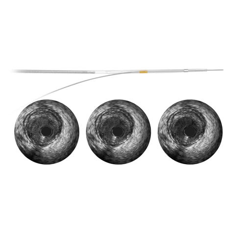 Diagnosekatheter - Revolution - Spectranetics - Koronar
