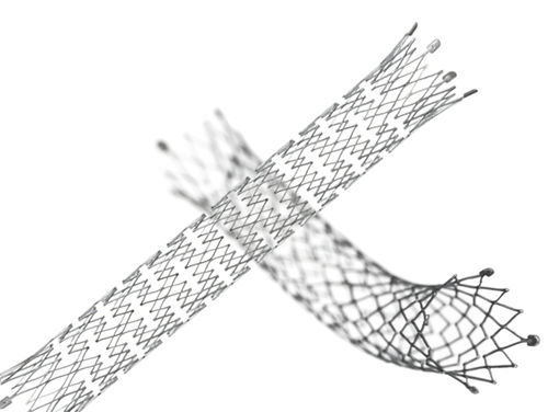 Venenstent -  E-LUMINEXX® - Bard Medical