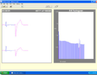Reporting-Software - Trillium Platinum™ - Forest Medical - Analyse / medizinisch / für Langzeit-EKG