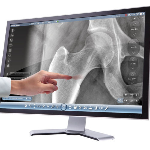 Software für Radiologie - Cuattro Europe - Bildanalyse / zur Infektionskontrolle / Projektentwicklung