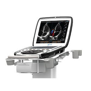 Ultraschallgerät / tragbar, mit Transportwagen - uSmart® 3300 NexGen  - Terason - für Ultraschalldiagnostik in Anästhesie und Intensivmedizin / für Ultraschalldiagnostik in der Notfallmedizin / für pharmakologische Stressechokardiographie