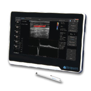 Tragbares Ultraschallgerät - uSmart® 3200T NexGen - Terason - für Ultraschalldiagnostik in der Notfallmedizin / für Ultraschalldiagnostik in Anästhesie und Intensivmedizin / Schwarz-Weiß