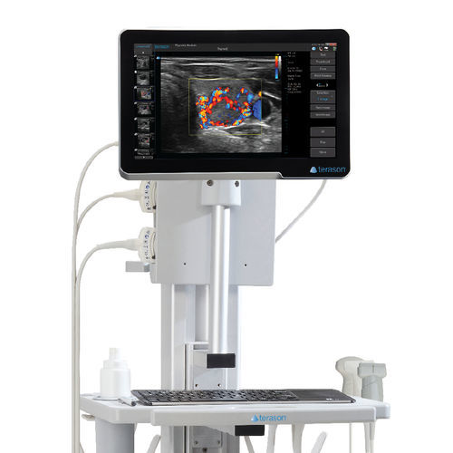 Ultraschallgerät / tragbar, mit Transportwagen - uSmart® 3200T Plus - Terason - für Multifunktions-Ultraschall / Schwarz-Weiß / Farbdoppler