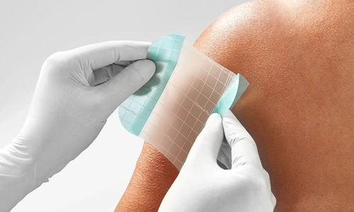 Transparentes Polsterbinde - Comfeel® Plus - Coloplast - Hydrokolloid / zur Heilung