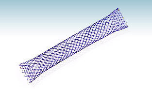 Kolorektaler Stent - HANAROSTENT® NNN - M.I Tech