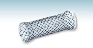 Tracheal-Stent - HANAROSTENT®(CCC) - M.I Tech