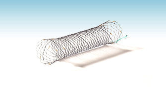 Zwölffingerdarm-Stent - TwynLay®(NCN) - M.I Tech