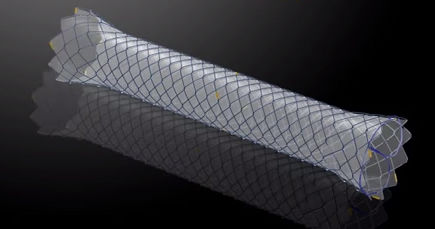 Dickdarm-Stent - HANAROSTENT®TTS (CCC) - M.I Tech - rektal
