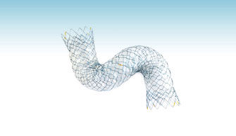 Dickdarm-Stent - TwynLay®(NCN) - M.I Tech
