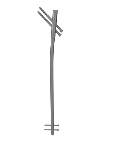 Marknagel für Oberschenkelknochen - A438 series - Aysam Orthopaedics - mit proximaler Fixierung / mit diaphysärer Fixierung / Titan