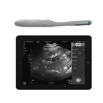 Ultraschall-Handgerät - CProbe-4TR  - Sonostar Technologies - für transvaginale Ultraschalluntersuchung / Schwarz-Weiß / Farbdoppler