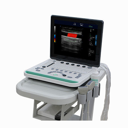 Ultraschallgerät / tragbar, mit Transportwagen - C5Pre - Sonostar Technologies - für Multifunktions-Ultraschall / Schwarz-Weiß / Farbdoppler