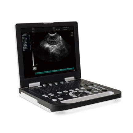 Tragbares Ultraschallgerät - SS-10 - Sonostar Technologies - für Multifunktions-Ultraschall / Schwarz-Weiß / 15 "