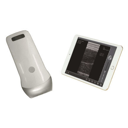 Tierärztliches Ultraschallsystem / Handgerät - UProbe-2B - Sonostar Technologies - Multifunktion / für Katzen / drahtlose Sonde