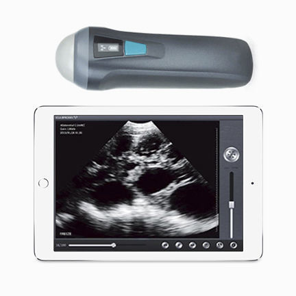 Ultraschall-Handgerät - UProbe-1  - Sonostar Technologies - für Multifunktions-Ultraschall / Schwarz-Weiß / bildgebende Allzwecksonde