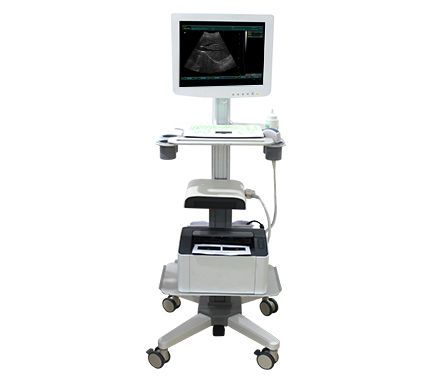 Ultraschallgerät mit Konsole - SS-100 Touch Screen Trolley Ultrasound Diagnosis B - Sonostar Technologies - für Multifunktions-Ultraschall / Farbdoppler