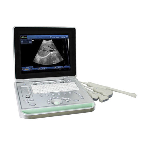 Tragbares Ultraschallgerät - SS-9 PC - Sonostar Technologies - für Ultraschalldiagnostik in Gynäkologie und Geburtshilfe / Schwarz-Weiß / 3D/4D