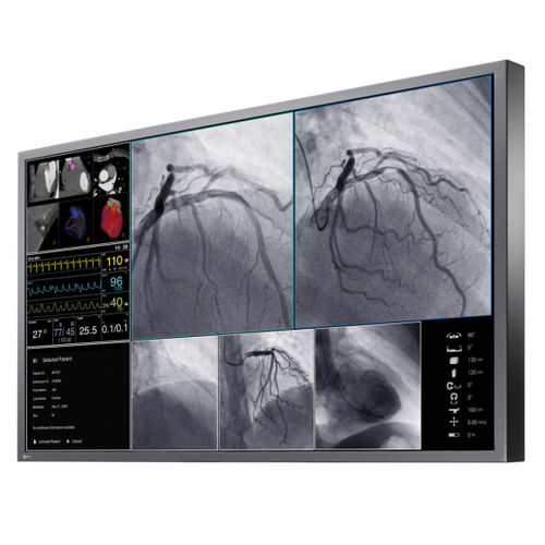 Monitor für OP-Bereich - CuratOR® LX550W - EIZO GmbH - für medizinische Bildgebung / 4K / 55"