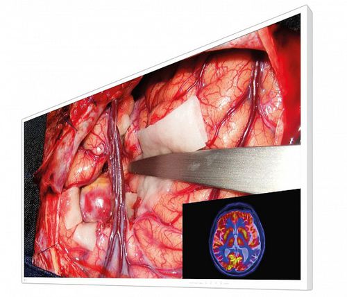 OP-Monitor - CuratOR® EX5542 - EIZO GmbH - medizinisch / 4K / 55"