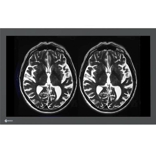 4K-OPVideoSystem - LX3240-MR - EIZO GmbH - 3840 × 2160