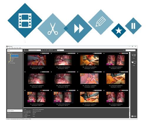 Verwaltungs- und Lagerungssystem / Daten - CuratOR MIR Browser - EIZO GmbH - Visualisierung / für medizinische Akten / Video