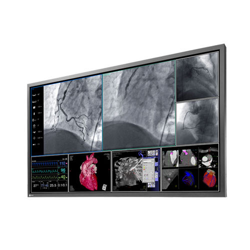 Monitor für OP-Bereich - RadiForce® LS580W - EIZO GmbH - für medizinische Bildgebung / hochauflösend / 58"