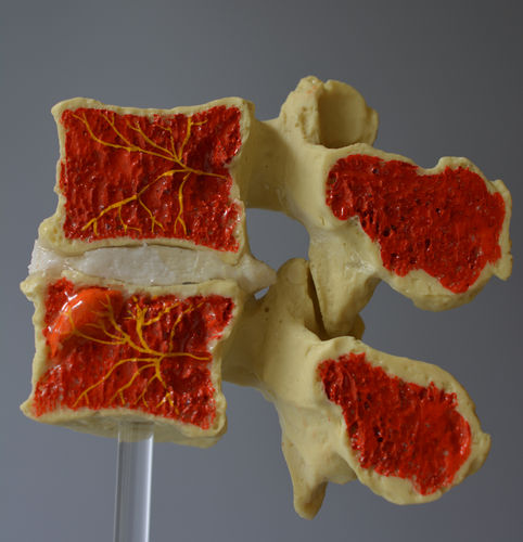 Anatomisches Modell / Bandscheibe - Modic - Dynamic Disc Designs Corp. - für die Ausbildung / mit Nerven / weiß
