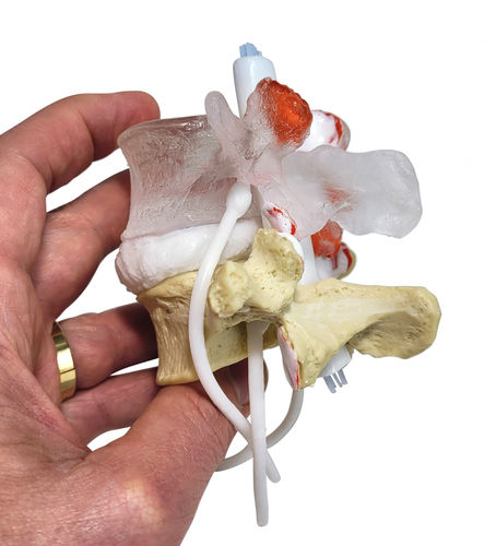 Anatomisches Modell / Lendenwirbel - Professional LxH - Dynamic Disc Designs Corp. - Bandscheibe / für die Ausbildung / mit Nerven