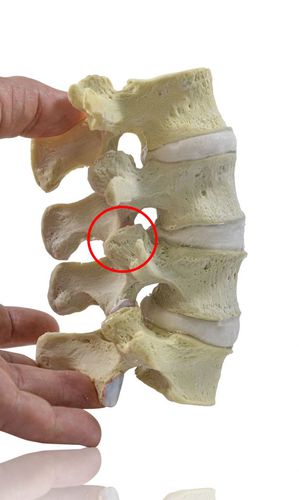 Anatomisches Modell / Knochen - L2-5  - Dynamic Disc Designs Corp. - Wirbel / Lendenwirbelsäule / für die Ausbildung