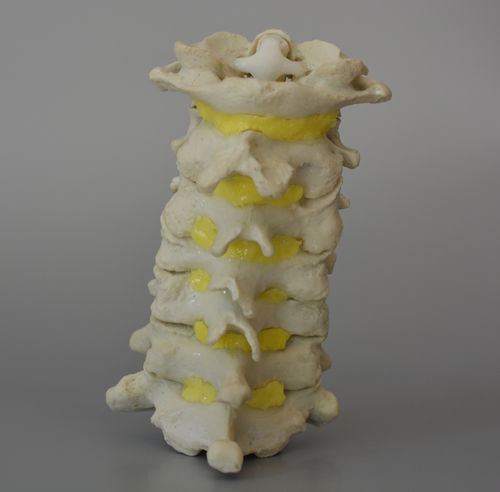 Halswirbelsäule anatomisches Modell - C1-7 - Dynamic Disc Designs Corp. - für die Ausbildung