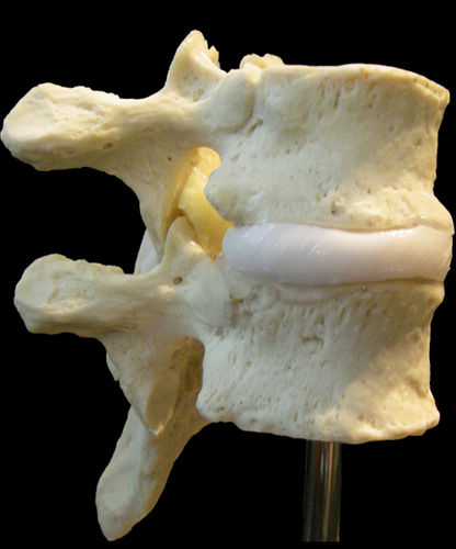 Anatomisches Modell / Bandscheibe - Dynamic Disc Designs Corp. - Brustwirbel / Gynäkologie / für die Ausbildung